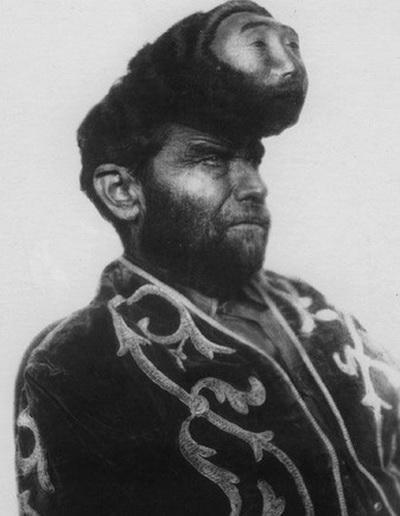 Люди в клетке: самые знаменитые персонажи цирка уродцев