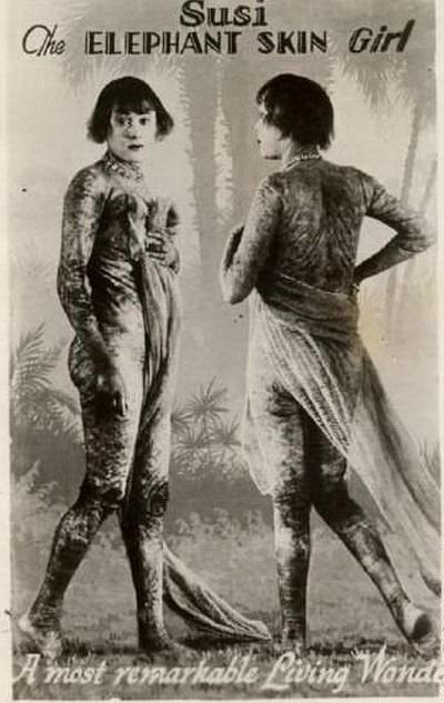 Люди в клетке: самые знаменитые персонажи цирка уродцев