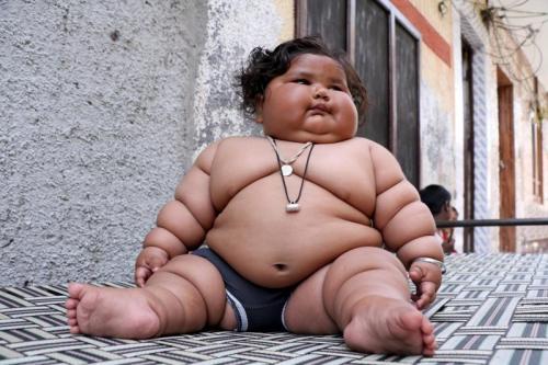 8-месячная девочка весит 17 килограмм, и продолжает толстеть