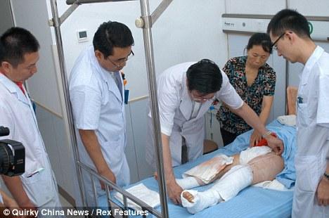 Девушке-кузнечику выправили ноги «коленками назад»