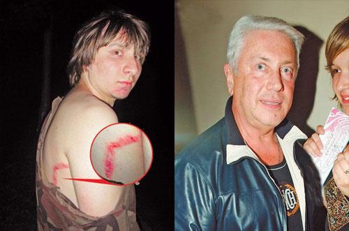 Избитые папарацци — как жертвы выходят из себя