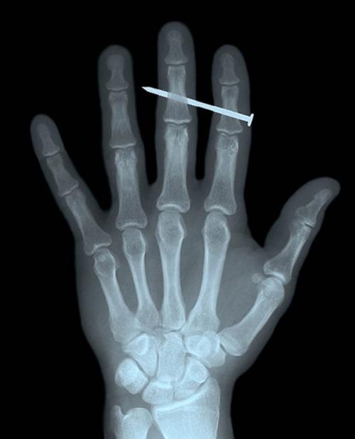 Самые невероятные рентгеновские снимки в истории медицины