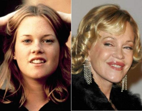 Звездные красавцы и красавицы, которые с годами подурнели