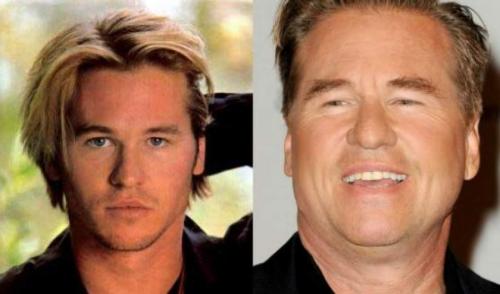 Звездные красавцы и красавицы, которые с годами подурнели