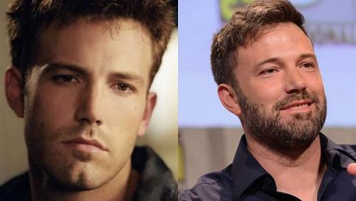 Звездные красавцы и красавицы, которые с годами подурнели