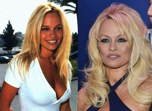 Звездные красавцы и красавицы, которые с годами подурнели