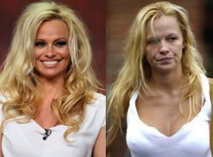 Звездные красавцы и красавицы, которые с годами подурнели