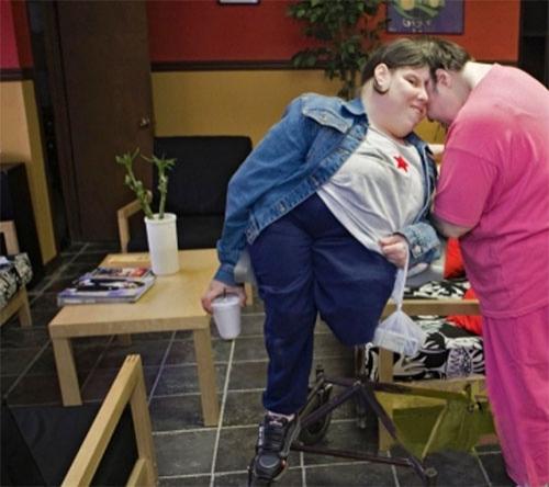 Старейшая пара сиамских близнецов, сросшихся головой, отметила 47-й день рождения