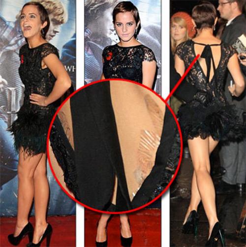 Спалились! Раскрываем все хитрости знаменитостей