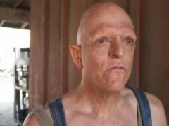 Знаменитости, которые остаются в шоу-бизнесе несмотря на болезни