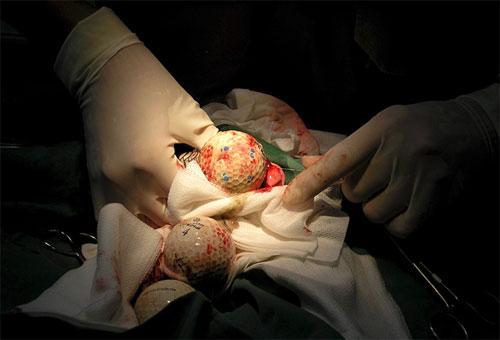 Самые удивительные операции на животных