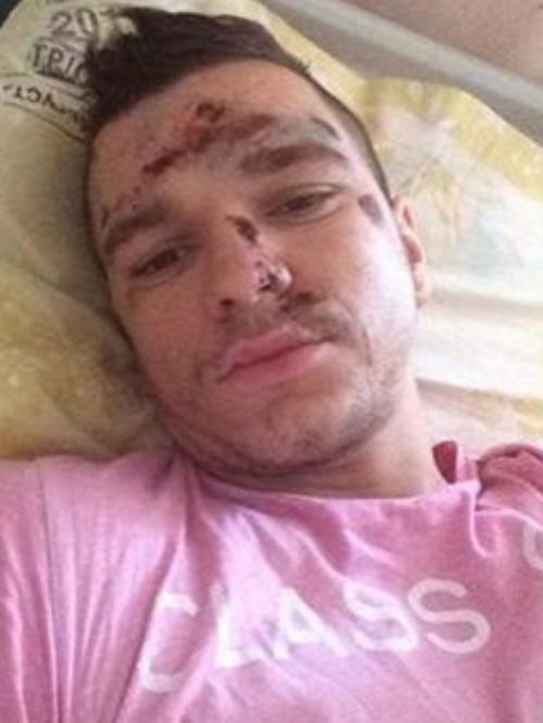 ДТП с участием звезд, в которых погибли или были ранены люди