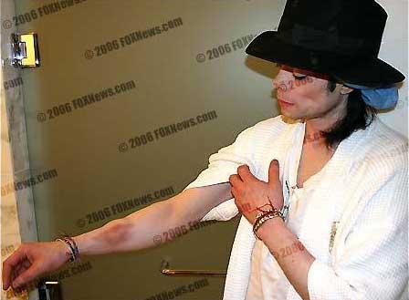 Майкла Джексона жестоко избили!