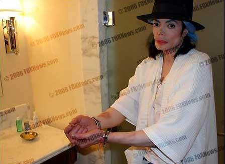 Майкла Джексона жестоко избили!