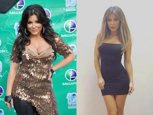 Стремительно похудевшие звезды, ставшие объектом для слухов