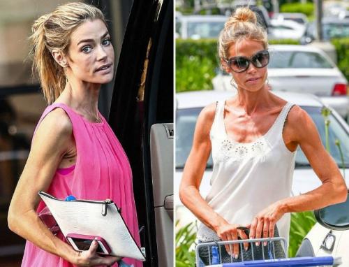 Звезды, которые напугали фанатов неожиданными переменами во внешности