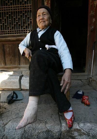 Китайской традиции деформации ступней — 1000 лет