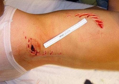 Самые страшные нападения животных на людей