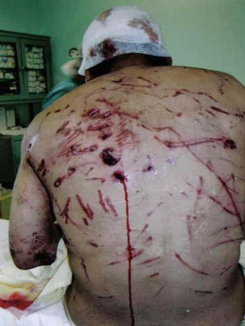 Самые страшные нападения животных на людей