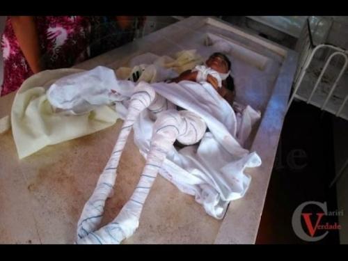 Самые страшные нападения животных на людей