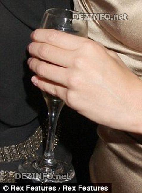 Дефекты, которые уродуют голливудских звезд