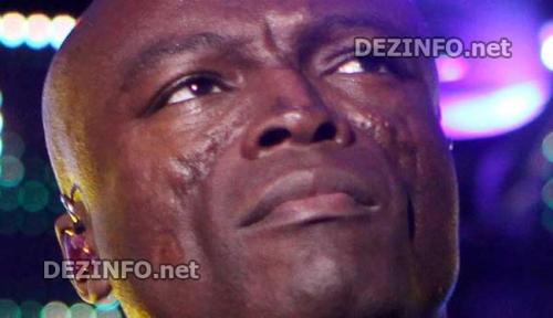 Дефекты, которые уродуют голливудских звезд