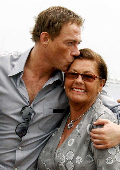 Дефекты, которые уродуют голливудских звезд