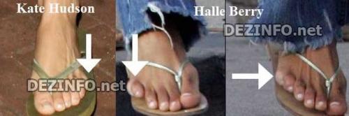 Дефекты, которые уродуют голливудских звезд