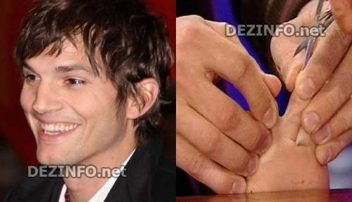 Дефекты, которые уродуют голливудских звезд