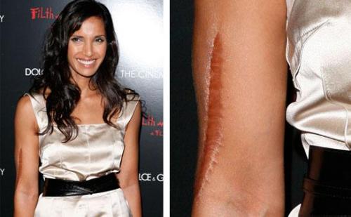 Дефекты, которые уродуют голливудских звезд