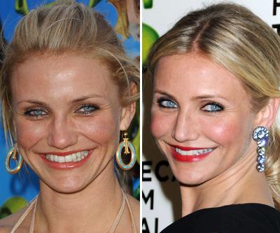 Топ-15 звезд с исправленным носом