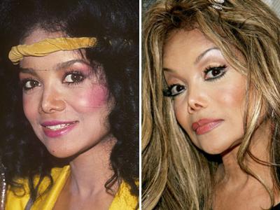 Топ-15 звезд с исправленным носом