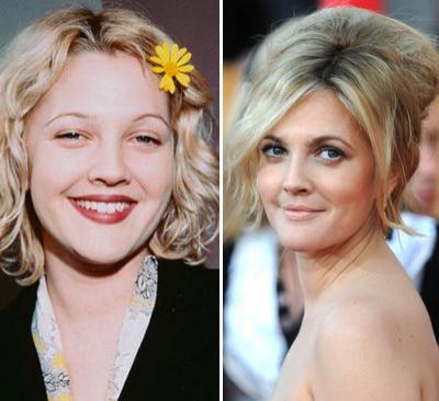 Топ-15 звезд с исправленным носом