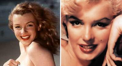 Топ-15 звезд с исправленным носом