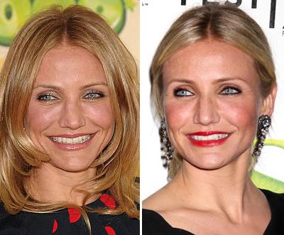 Топ-15 звезд с исправленным носом