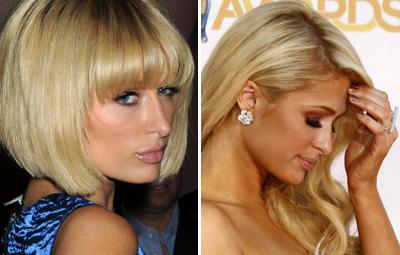 Топ-15 звезд с исправленным носом