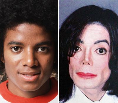 Топ-15 звезд с исправленным носом