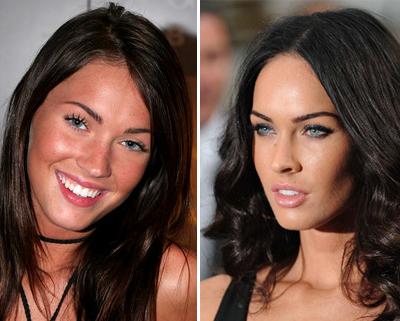 Топ-15 звезд с исправленным носом