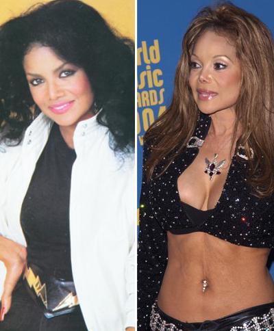 Топ-15 звезд с исправленным носом