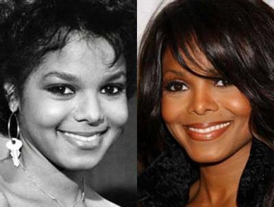 Топ-15 звезд с исправленным носом