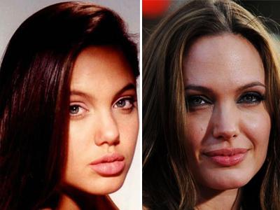 Топ-15 звезд с исправленным носом