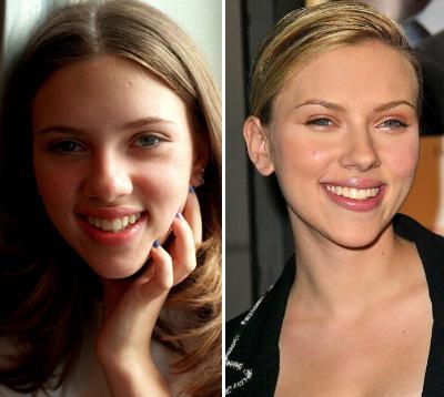 Топ-15 звезд с исправленным носом