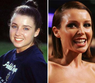 Топ-15 звезд с исправленным носом