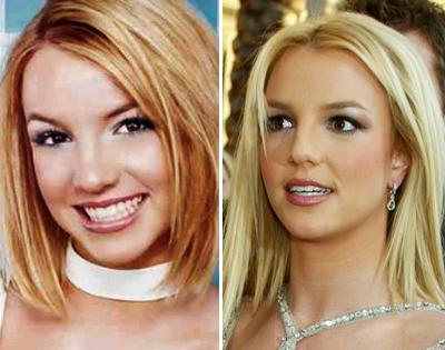 Топ-15 звезд с исправленным носом