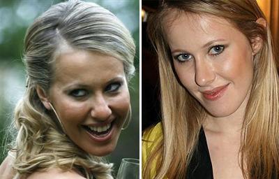 Топ-15 звезд с исправленным носом