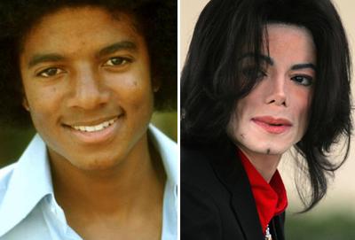 Топ-15 звезд с исправленным носом