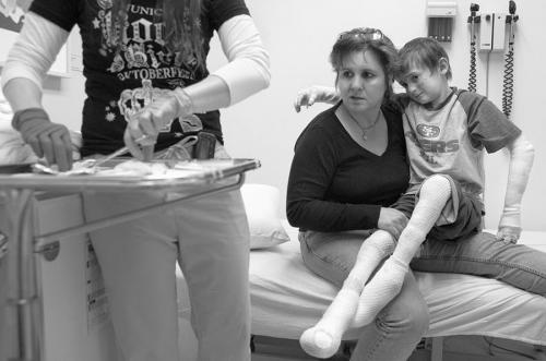 Американский мальчик живёт без кожи