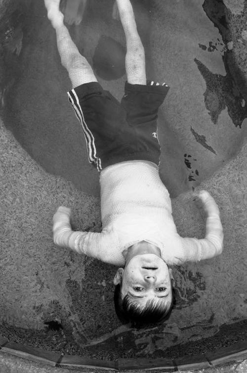 Американский мальчик живёт без кожи