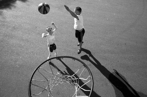 Американский мальчик живёт без кожи