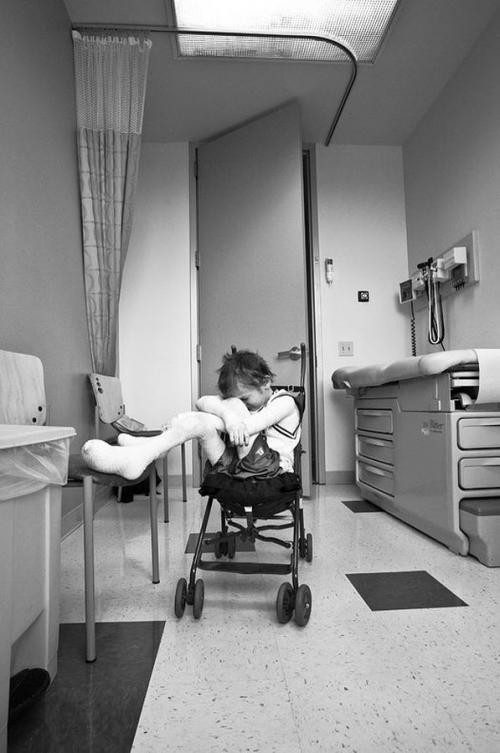 Американский мальчик живёт без кожи